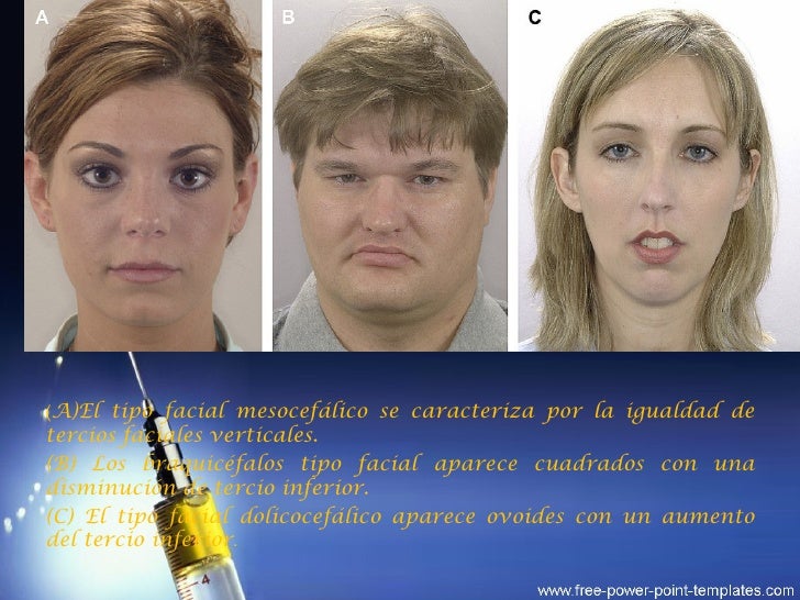 Ndice facial morfol gico Free fisting porno gallaries